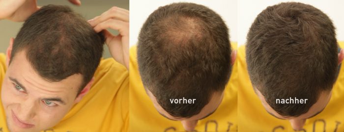 Cover Hair Fibres Hair Loss Concealer Cortex Hair